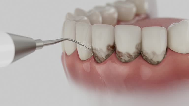 Trusted Dental Implants service in Bon Air, VA - Dentist Open Now